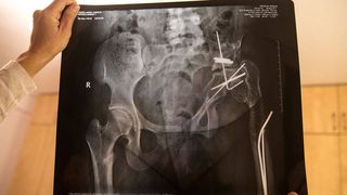 Amira a fost pacienta profesorului Burnei