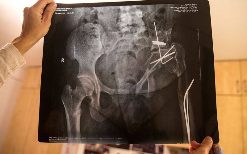 Amira a fost pacienta profesorului Burnei