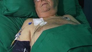 In 2013, Arsinel a suferit un transplant la rinichi