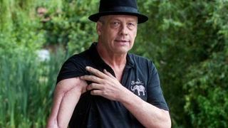 Un barbat a fost la un pas de moarte, dupa ce a fost muscat de un paianjen ascuns intr-un ciorchine de banane