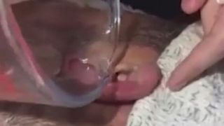 Simtea ca se misca ceva in ureche, asa ca si-a rugat familia sa se uite mai bine. I-au turnat apa calduta in ureche si au fost ingroziti de ce a iesit de acolo