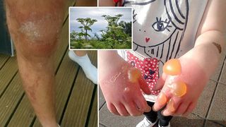 Planta care face ravagii in randul populatiei. S-a raspandit extrem de mult si tot mai multe persoane sunt afectate de toxinele continute - Sute de cazuri grave au fost semnalate