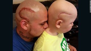 Si-a facut un tatuaj identic cu cicatricea fiului sau, operat pe creier. Ce s-a intamplat cu copilul la un an dupa ce povestea lor a facut inconjurul lumii