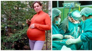 Timp de 9 luni, medicii i-au spus ca este insarcinata cu gemeni. Ce s-a gasit in burta femeii in timpul operatiei de cezariana este de-a dreptul socant. Politistii investigheaza cazul