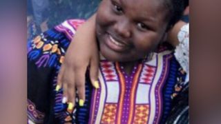 I-au aruncat apa clocotita pe fata, in timp ce dormea. O copila de 11 ani  a fost desfigurata pe viata, dupa ce prietena ei de 12 ani i-a facut asta