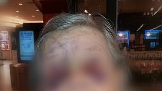 Imagini cu un puternic impact emotional! O batranica a fost batuta crunt de ginerele ei. Femeia este desfigurata