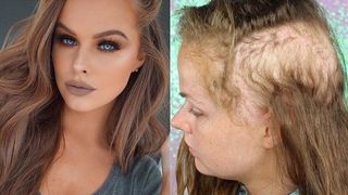 Avea o frumusete iesita din comun, dar intr-o zi s-a trezit asa. Simptomele cumplitei boli pe care nu ar trebui nici tu sa le ignori