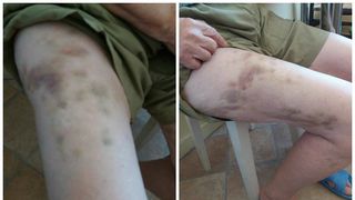 A stat 4 luni intr-un camin de batrani, dar s-a intors acasa plina de vanatai. Nora femeii a povestit ce s-a intamplat pe Facebook: E bucuroasa ca a "scapat de la puscarie"