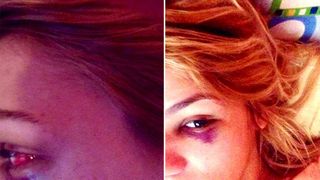 Strigatul disperat de ajutor al unei tinere din Targu Jiu care este batuta si amenintata de sot - "Asta e doar 1% din ce mi-a facut!"