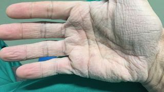 Asa arata mana unui medic, dupa 12 ore de interventii chirurgicale! Fotografia a devenit virala