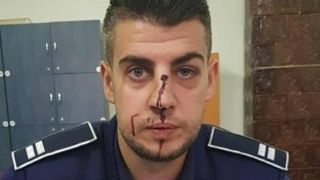 Ancheta de proportii in Dolj! Politist batut in misiune. "Acum o saptamana, un cocalar se lauda pe Facebook ca o sa il taie cu un cutit pentru ca i-a luat permisul"