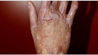 O supravietuitoare din Colectiv povesteste calvarul pe care l-a trait la Spitalul de Arsi: "Se casca un hau de carne acolo, din care curge neostoit sange" rosu, gros. Inchid ochii ca sa nu mai vad, dar simt apa calda-rece scurgand-se peste mine