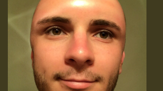 S-a ales cu o gaura in cap dupa ce s-a expus prea mult la soare - "Nici eu nu stiu cum s-a intamplat asta"