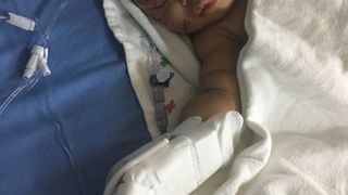 O fetita de 4 luni a ajuns la spital cu rani grave, dupa ce a fost atacata de un raton