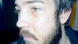 Clipe de groaza pentru un tanar din Cluj. A fost lovit in cap si talharit in apropierea unui popular club din oras