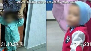 Cum arata acum baiatul care la 4 ani cantarea doar 7 kilograme! Medicii l-au tratat cu ciocolata: "E o minune"