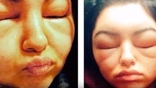 I s-a umflat fata si a orbit temporar dupa ce a facut o greseala pe care multe femei o fac - Oare aceste lucruri din comert ar trebui interzise?