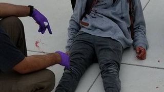 Copil cu handicap, batut in ultimul hal de colegii de scoala si lasat intr-o balta de sange