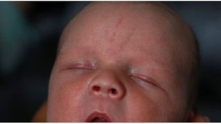 A nascut un bebelus perfect sanatos, dar cand i-au deschis gura, au incremenit! Nici medicii nu au mai vazut asa ceva