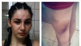 "Printesa Razboinica" de la Exatlon, marturisire EMOTIONANTA: "Nu imi voi ascunde urmele luptelor ca o fetita"