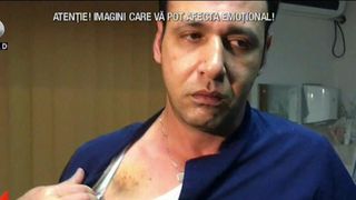 Dezvaluiri socante despre barbatul care a snopit in bataie un medic de la spitalul din Mioveni! Cine este in realitate batausul