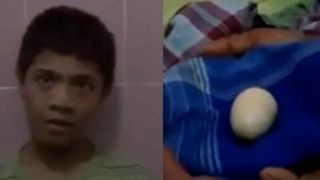 Caz socant! Un baiat depune oua precum pasarile! Nici macar specialistii nu au putut sa-i dea de cap!