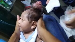 Au avut un soc atunci cand bebelusul lor s-a nascut! Micutul avea o malformatie care nu s-a vazut la control: "El este bebelusul unicorn"