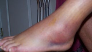 Batai si scandal intr-un liceu din Suceava. O profesoara si-a iesit din minti lovind un elev in sala de clasa a IX-a. Scenele violente au fost filmate de colegii adolescentului