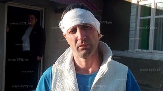 El este vasluianul care a ramas fara ureche, dupa ce prietenul lui cel mai bun l-a muscat!