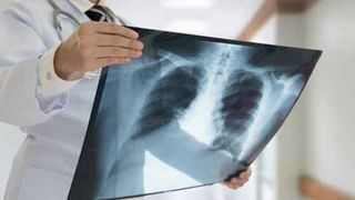 Analize gratuite pe care orice persoana trebuie sa le faca. Cu trimitere de la medicul de familie nu vei plati niciun ban