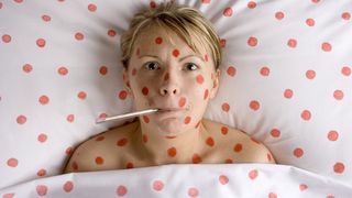 Varsat de vant: simptome si tratament pentru boala copilariei