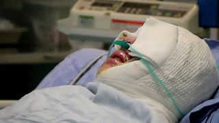 Un barbat din Iasi a ajuns in stare grava la spital, cu arsuri pe fata, dupa ce a fost stropit cu o substanta periculoasa de catre doi tineri!