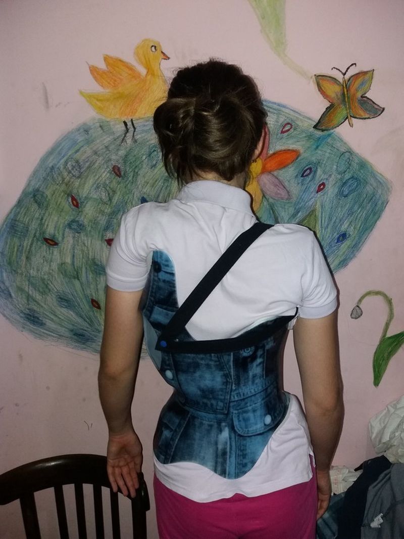 Asa arata corsetul pe care il poarta Aureliana
