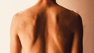 Durerile de spate - 3 cauze generate de pozitia corpului si remediile pentru acestea