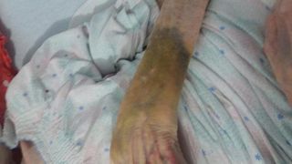 Caz revoltator intr-un azil de batrani! O pacienta a fost luata la palme de infirmiera