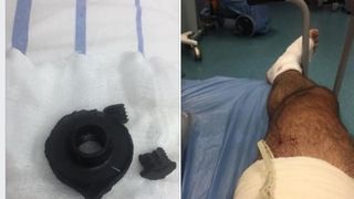 Ancheta la Spitalul Universitar din Bucuresti, dupa ce un protestatar a contractat o infectie nosocomiala