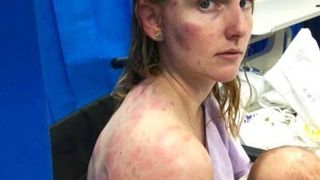 Şi-a apărat copilul ca o leoaică şi a ajuns &icirc;n starea asta la spital. O mamă şi-a văzut moarte cu ochii, după ce natura s-a dezlănţuit