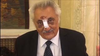 Deputatul Nicolae Bacalbaşa a apărut cu nasul bandajat în Parlament: "Nasul, chit ca s-a rupt, m-a protejat". Ce a păţit