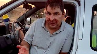 Zidar rom&acirc;n, bătut cu bestialitate de către şapte persoane &icirc;ntr-un parc din Italia