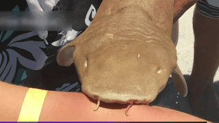 O femeie, muscata de un rechin, a ajuns la spital cu pestele inca atasat de brat!