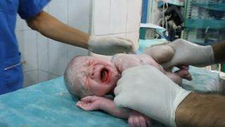 Doctorii fac minuni in Siria. Medicii din Alep au readus la viata un prunc scos fara suflare din pantecele mamei, ranita in urma unui atac