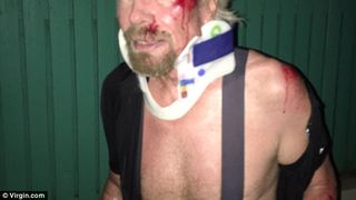 Miliardarul Richard Branson, accident aproape mortal cu bicicleta: "Am crezut ca o sa mor"