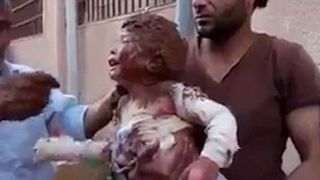 Cel putin 17 oameni, ucisi dupa ce armata siriana a atacat mai multe zone din provincia Hama. Momentul in care o fetita este data cu noroi pe arsurile de la napalm pentru a-i calma durerile