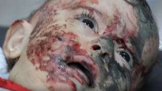 Asa arata fata razboiului: cenusa si sange. Drama prin care trece aceasta micuta prinsa in mijlocul conflictului