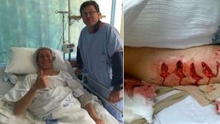 Un surfer de 17 ani a fost inhatat de un rechin de peste 3 metri. Pestele rapitor si-a infipt coltii in piciorul tanarului