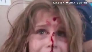 Bombardamente in Siria. O fetita de 8 ani ranita si speriata plange dupa tatal ei.