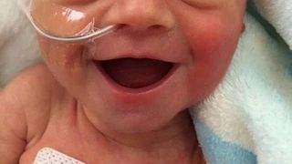 S-a nascut prematur si medicii nu stiau daca va supravietui. La 5 zile de la nastere, fetita a fost fotografiata zambind: "E fericita ca traieste"