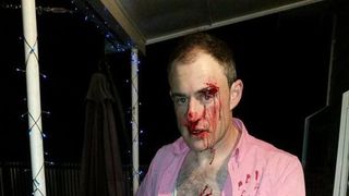 Un barbat a fost batut pentru ca purta o camasa roz: "Camasi roz poarta homosexualii"