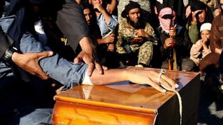 Jihadistii ISIS au amputat mainile a doi copii de 10 si 12 ani pentru ca au refuzat sa ucida