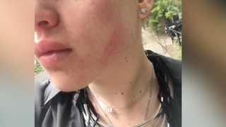 Fiica unui jurnalist, batuta crunt de un sofer agresiv! A luat-o la pumni pentru ca parca prea incet